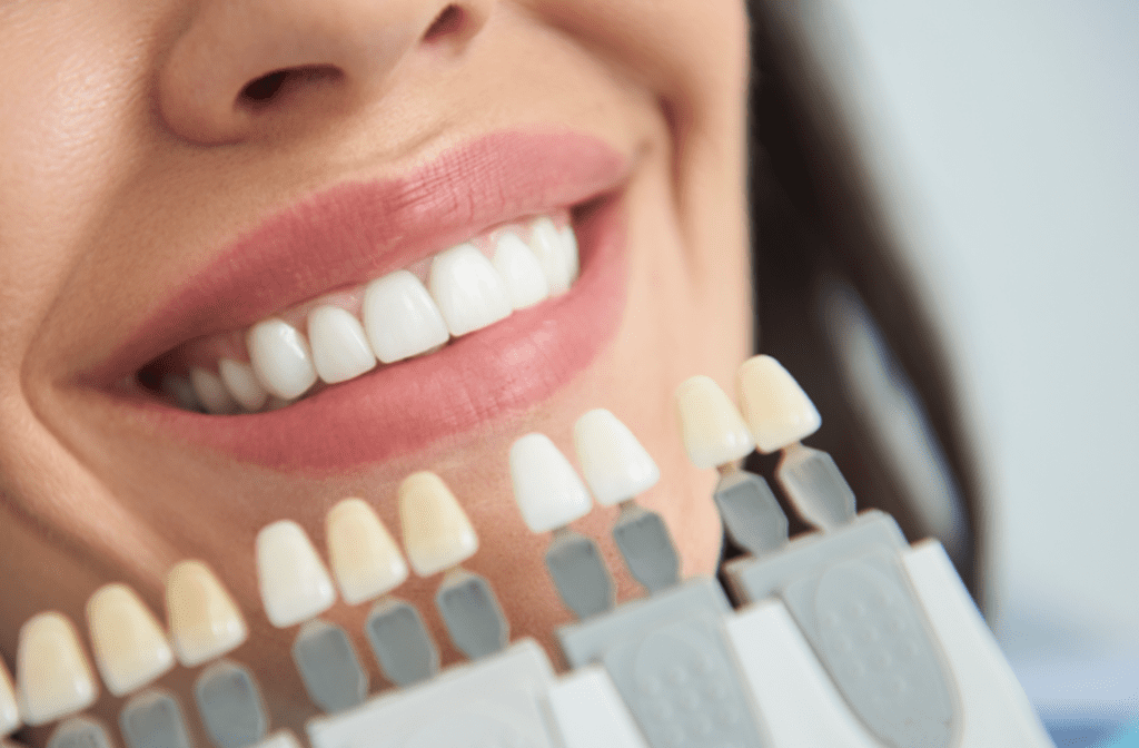 veneer teeth veneer