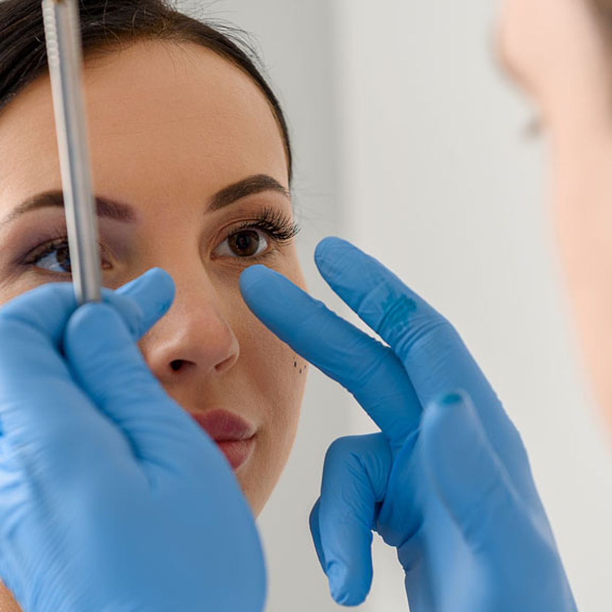 rhinoplasty rhinoplasty